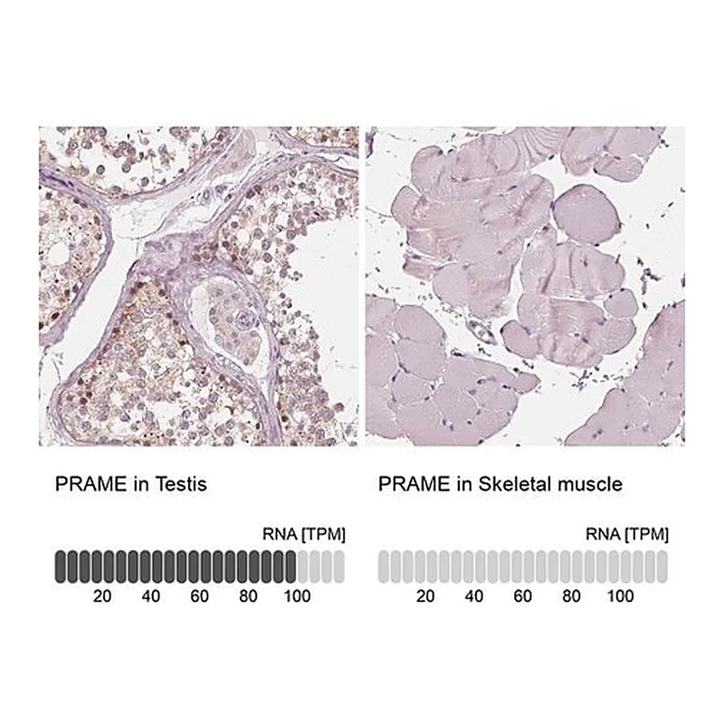 Merck Anti-PRAME antibody produced in rabbit
