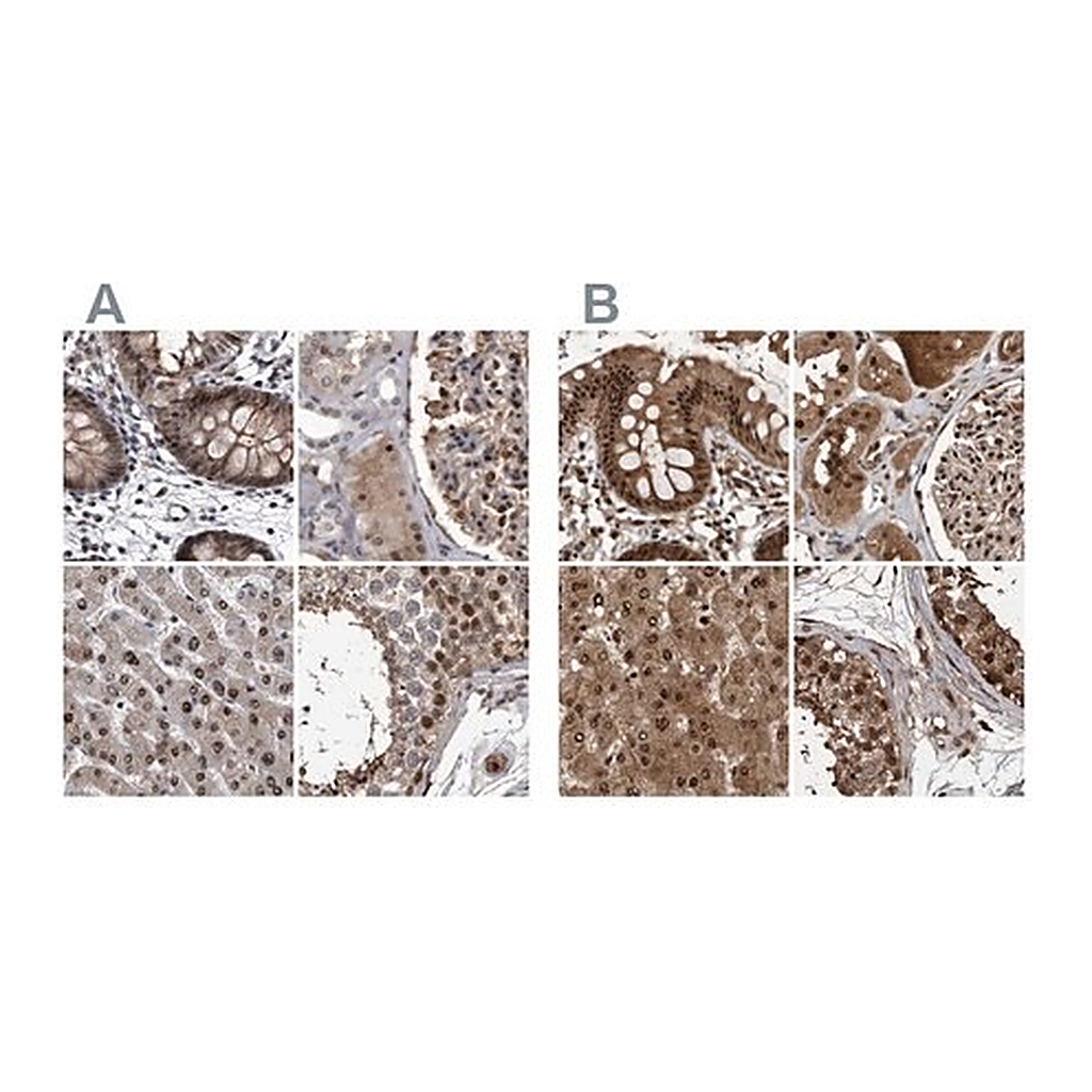 Merck Anti-RAD23B antibody produced in rabbit