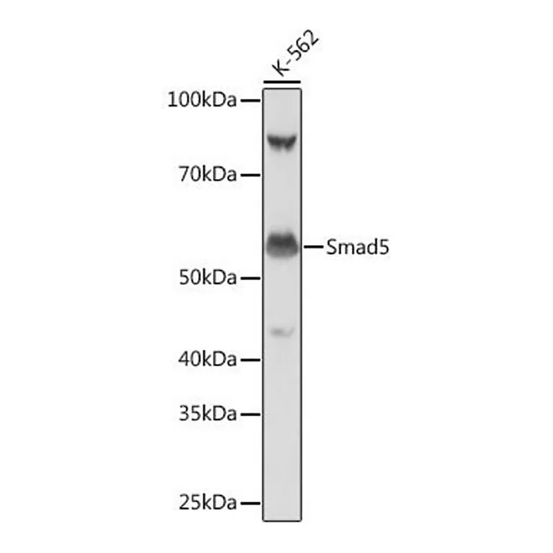 Merck Anti- Smad5 antibody produced in rabbit