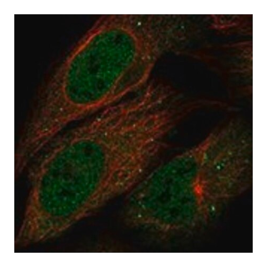 Merck Anti-B4GALNT4 antibody produced in rabbit