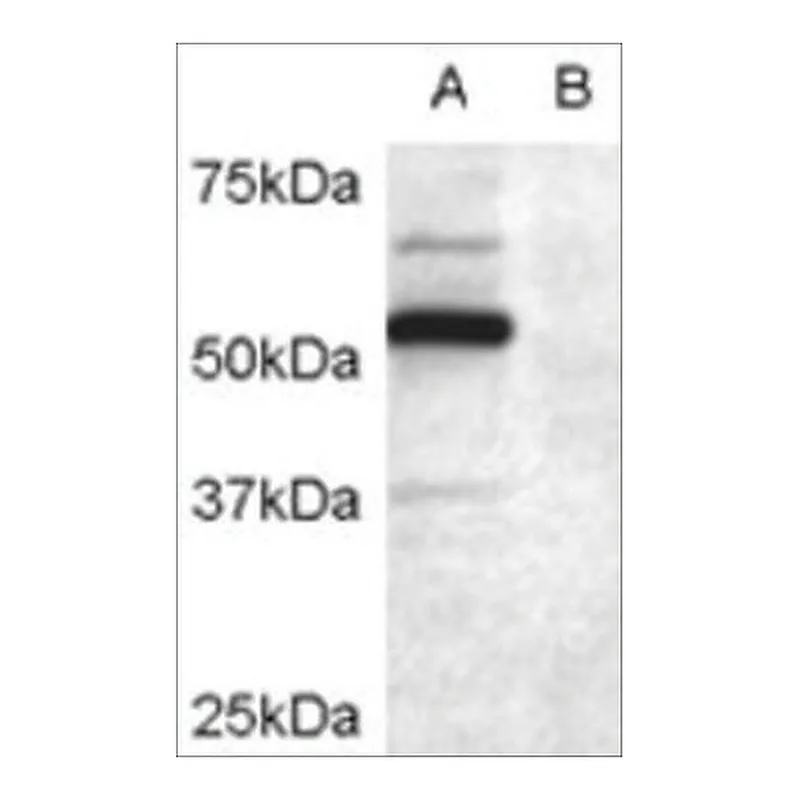 Merck Anti-DCDC2 antibody produced in goat