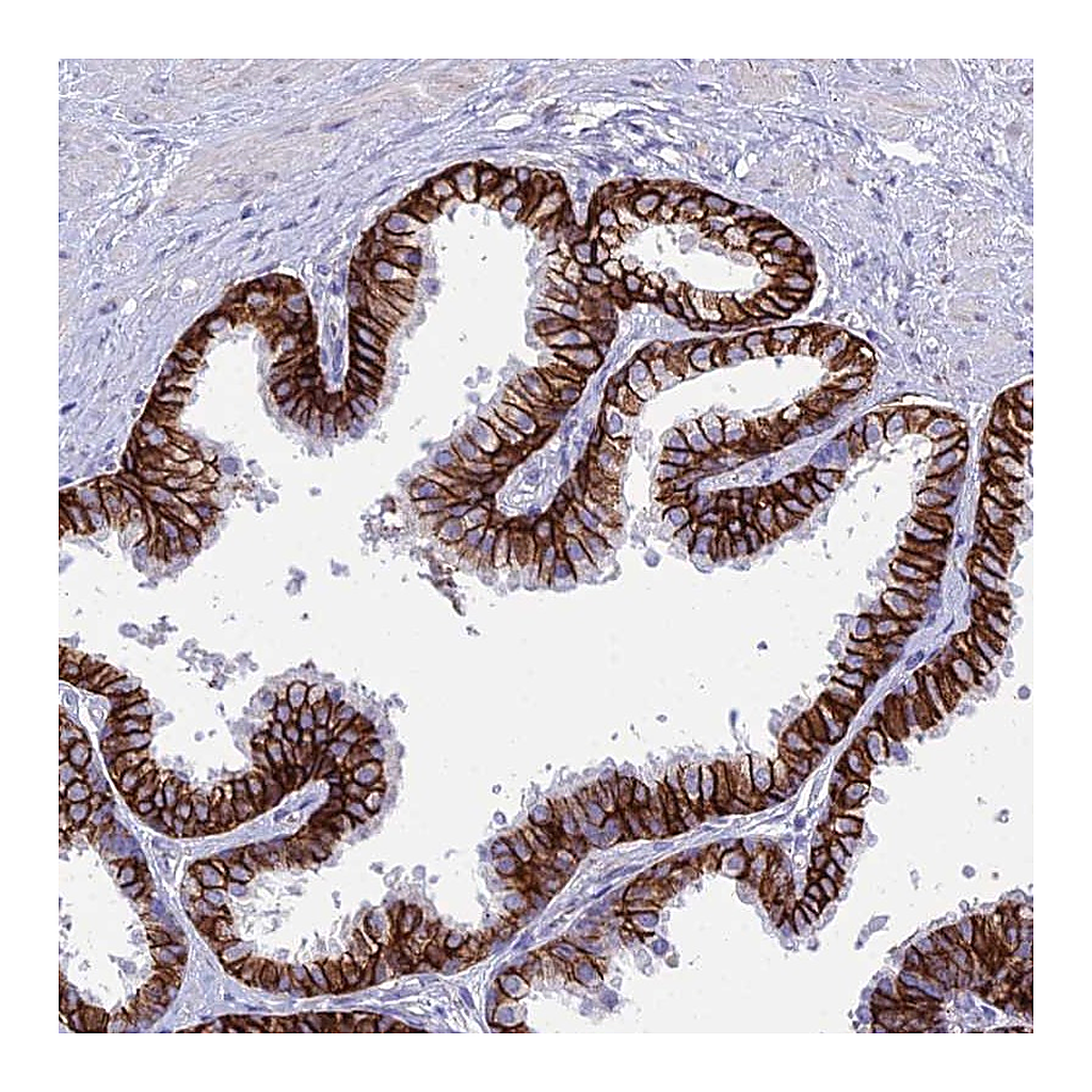 Atlas Antibodies Anti-OR1Q1 Antibody