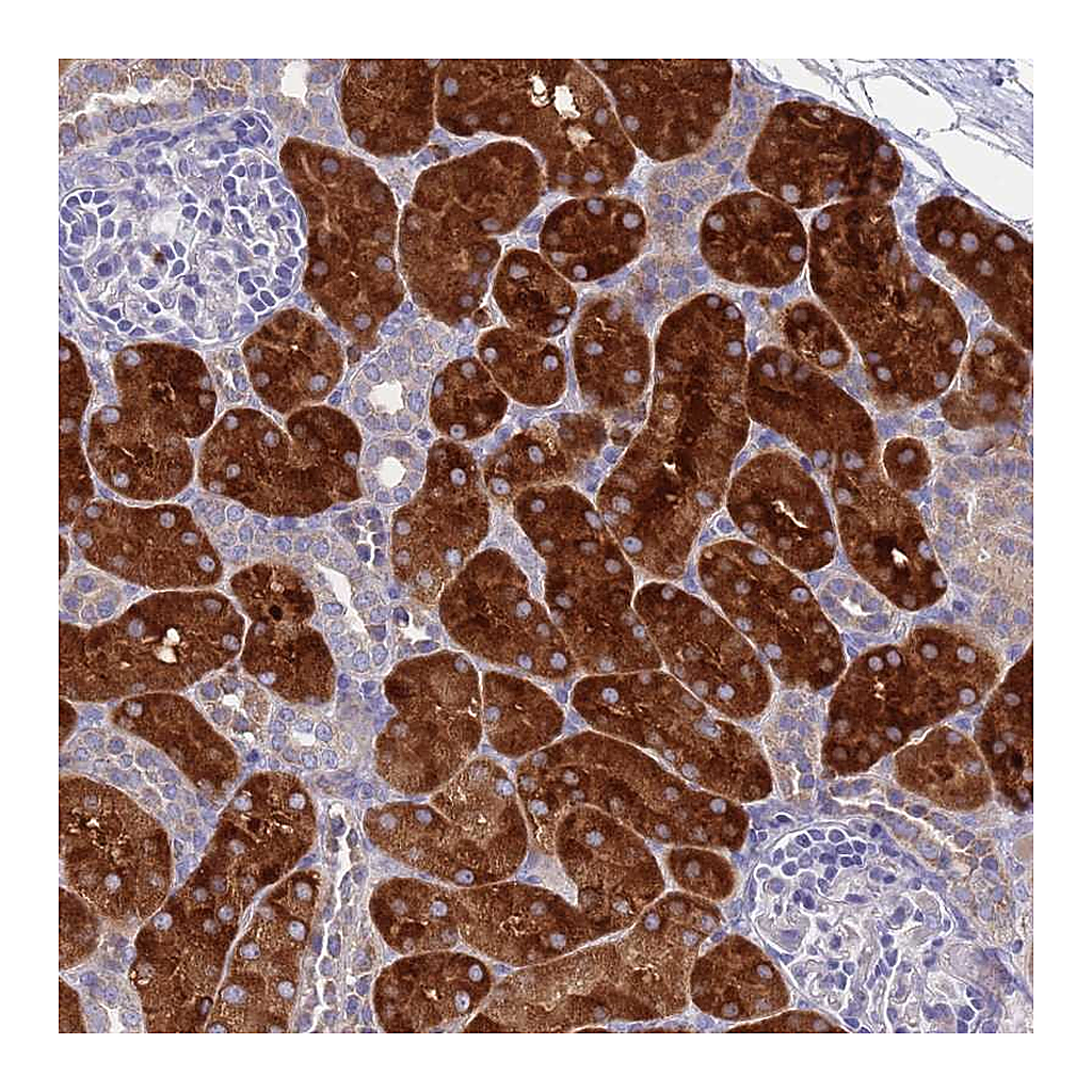 Atlas Antibodies Anti-OR1S2 Antibody