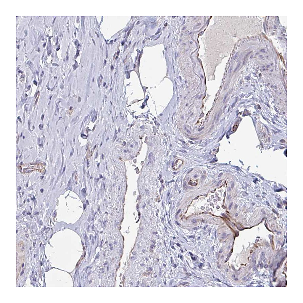 Atlas Antibodies Anti-OR1L3 Antibody