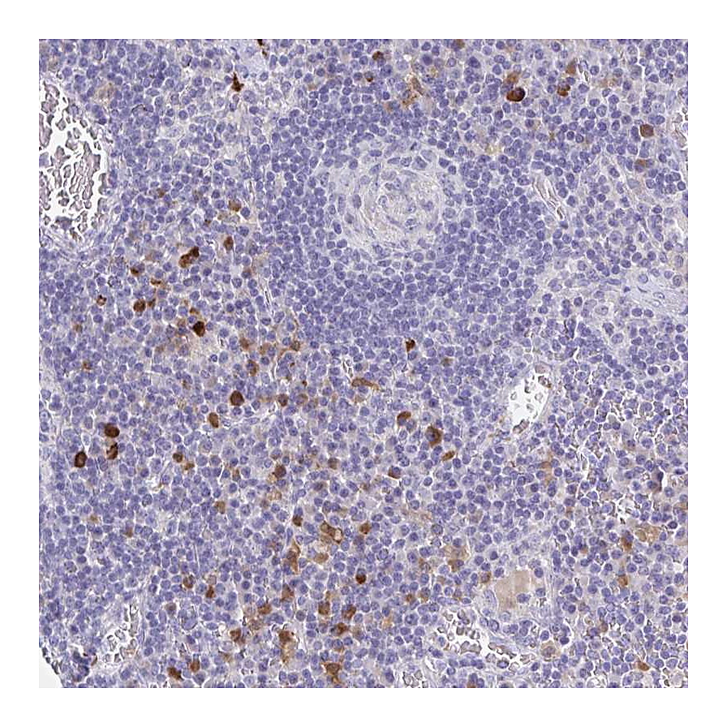 Atlas Antibodies Anti-OR2A4 Antibody