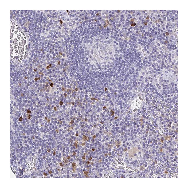 Atlas Antibodies Anti-OR2A4 Antibody