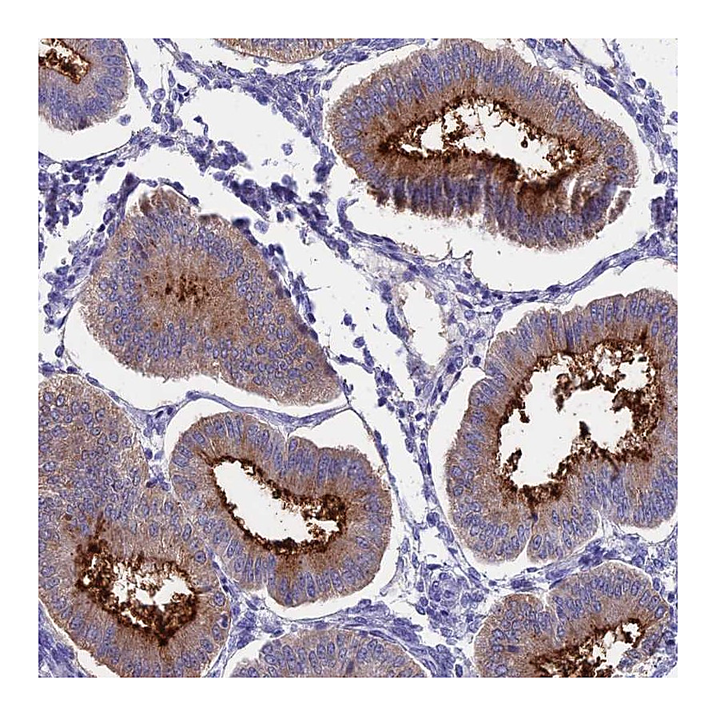 Atlas Antibodies Anti-OR2AE1 Antibody
