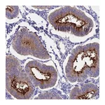 Atlas Antibodies Anti-OR2AE1 Antibody
