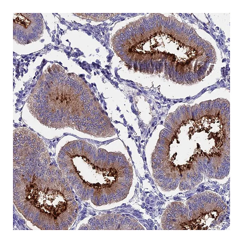 Atlas Antibodies Anti-OR2AE1 Antibody