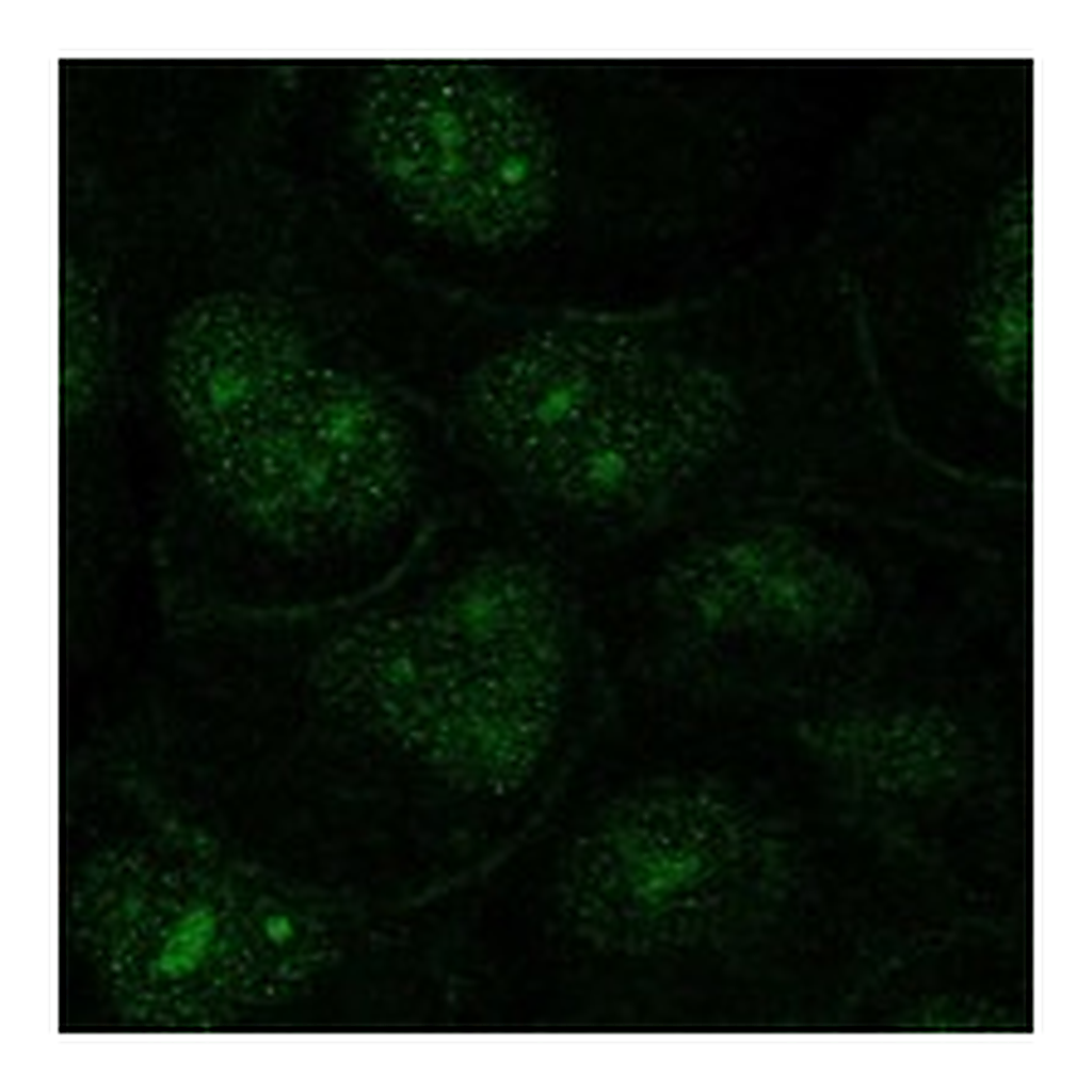 Atlas Antibodies Anti-OR1N2 Antibody