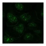 Atlas Antibodies Anti-OR1N2 Antibody