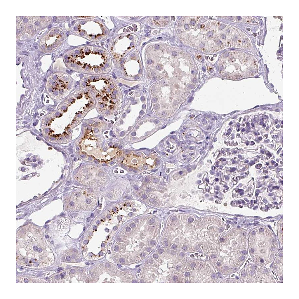 Atlas Antibodies Anti-OR2AK2 Antibody