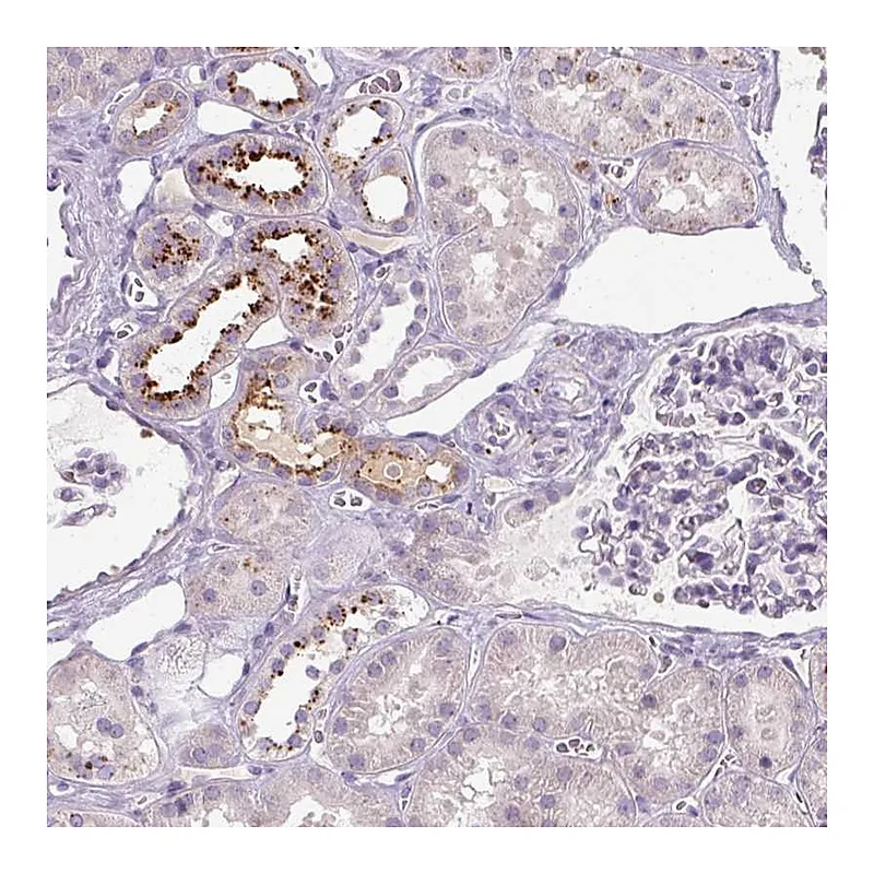 Atlas Antibodies Anti-OR2AK2 Antibody
