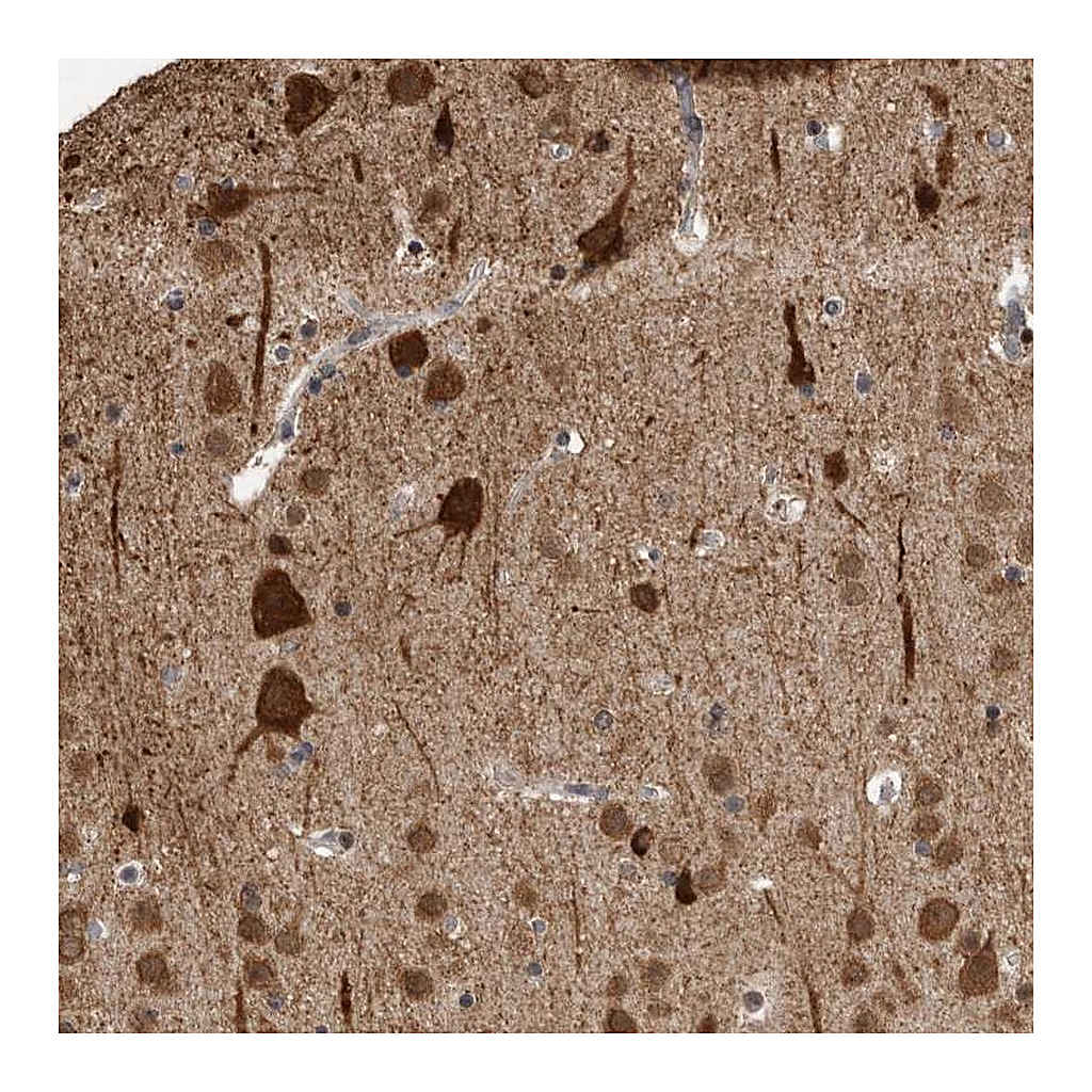 Atlas Antibodies Anti-OR2K2 Antibody