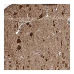Atlas Antibodies Anti-OR2K2 Antibody