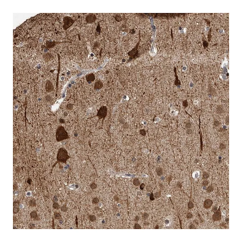 Atlas Antibodies Anti-OR2K2 Antibody