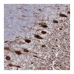 Atlas Antibodies Anti-OR2T1 Antibody