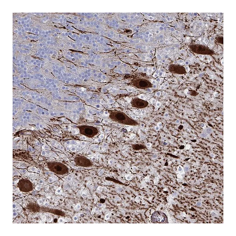 Atlas Antibodies Anti-OR2T1 Antibody
