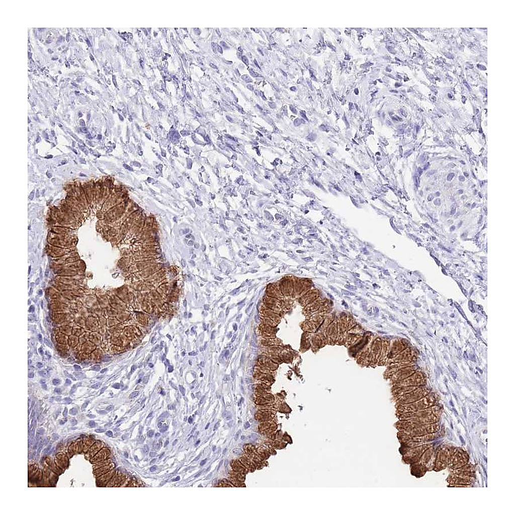Atlas Antibodies Anti-OR2Z1 Antibody