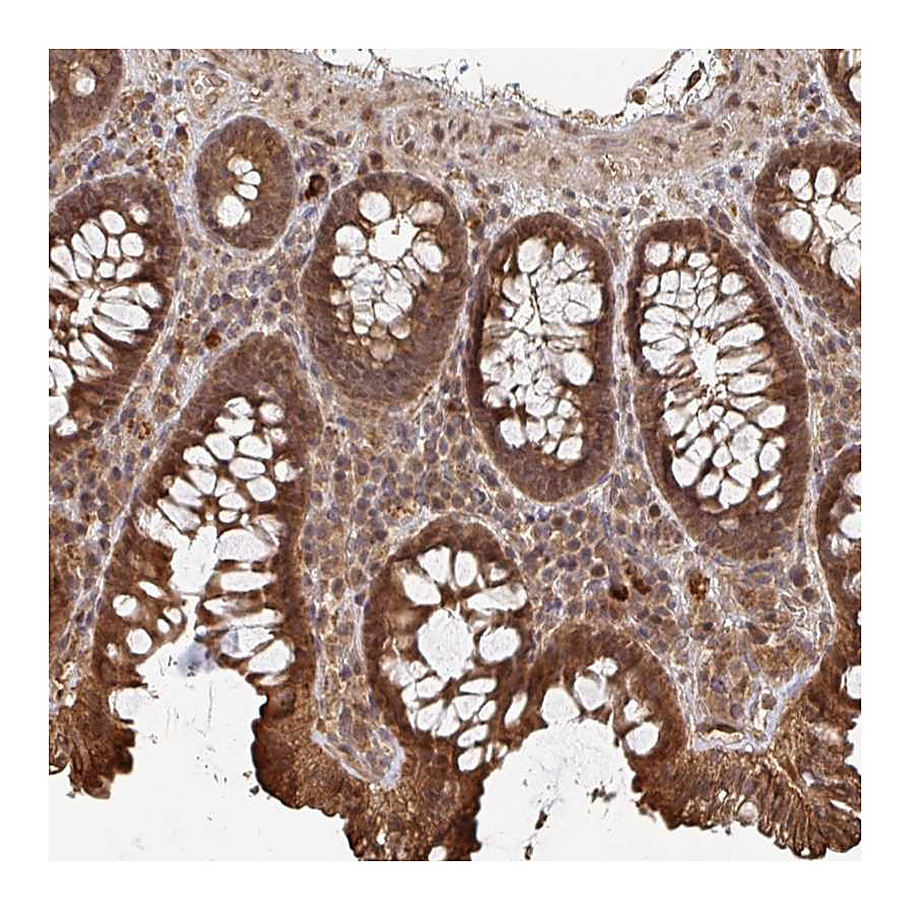 Atlas Antibodies Anti-OR4C15 Antibody
