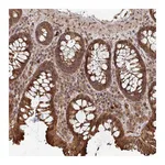 Atlas Antibodies Anti-OR4C15 Antibody