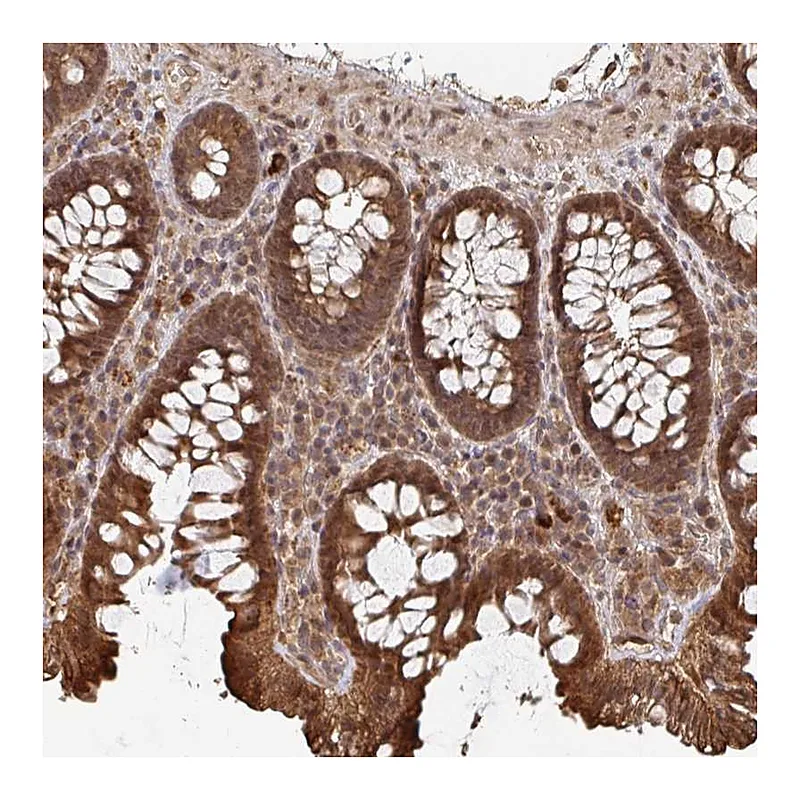 Atlas Antibodies Anti-OR4C15 Antibody