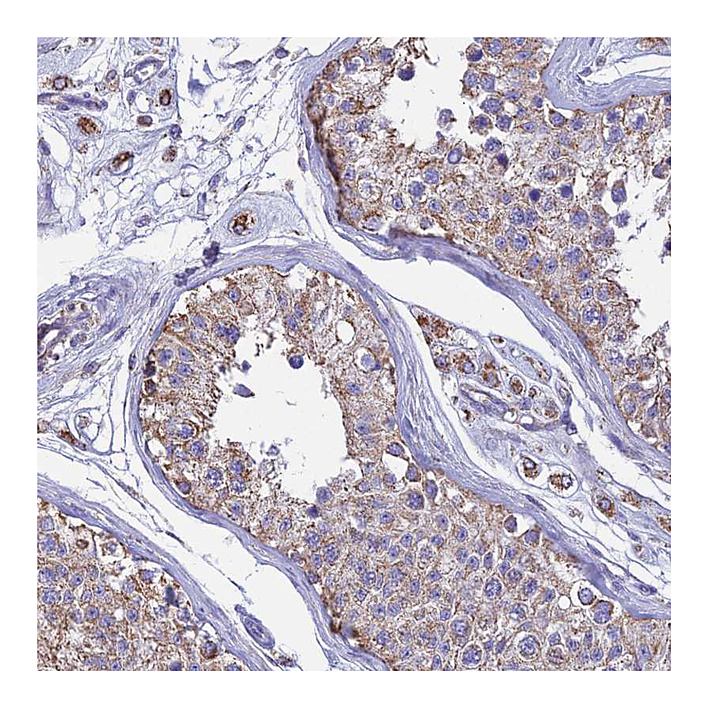 Atlas Antibodies Anti-OR2W3 Antibody