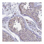 Atlas Antibodies Anti-OR2W3 Antibody
