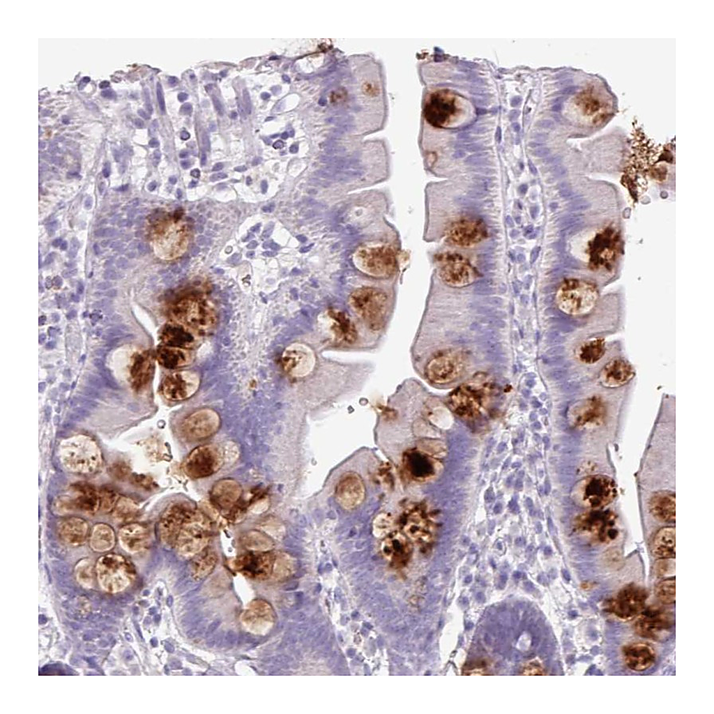 Atlas Antibodies Anti-OR2T10 Antibody
