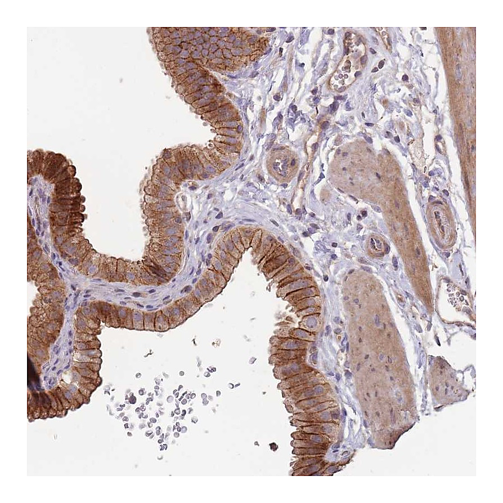 Atlas Antibodies Anti-OR4C3 Antibody