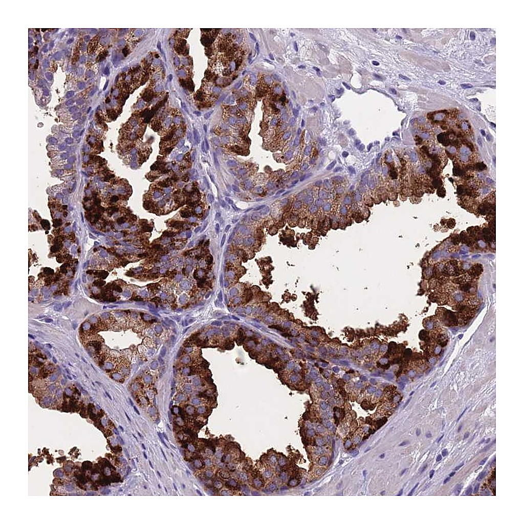 Atlas Antibodies Anti-OR4C5 Antibody
