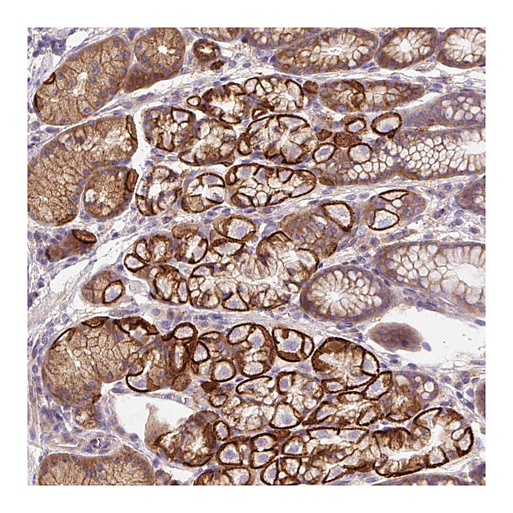 Atlas Antibodies Anti-OR4K15 Antibody