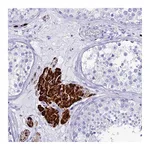 Atlas Antibodies Anti-OR4D5 Antibody