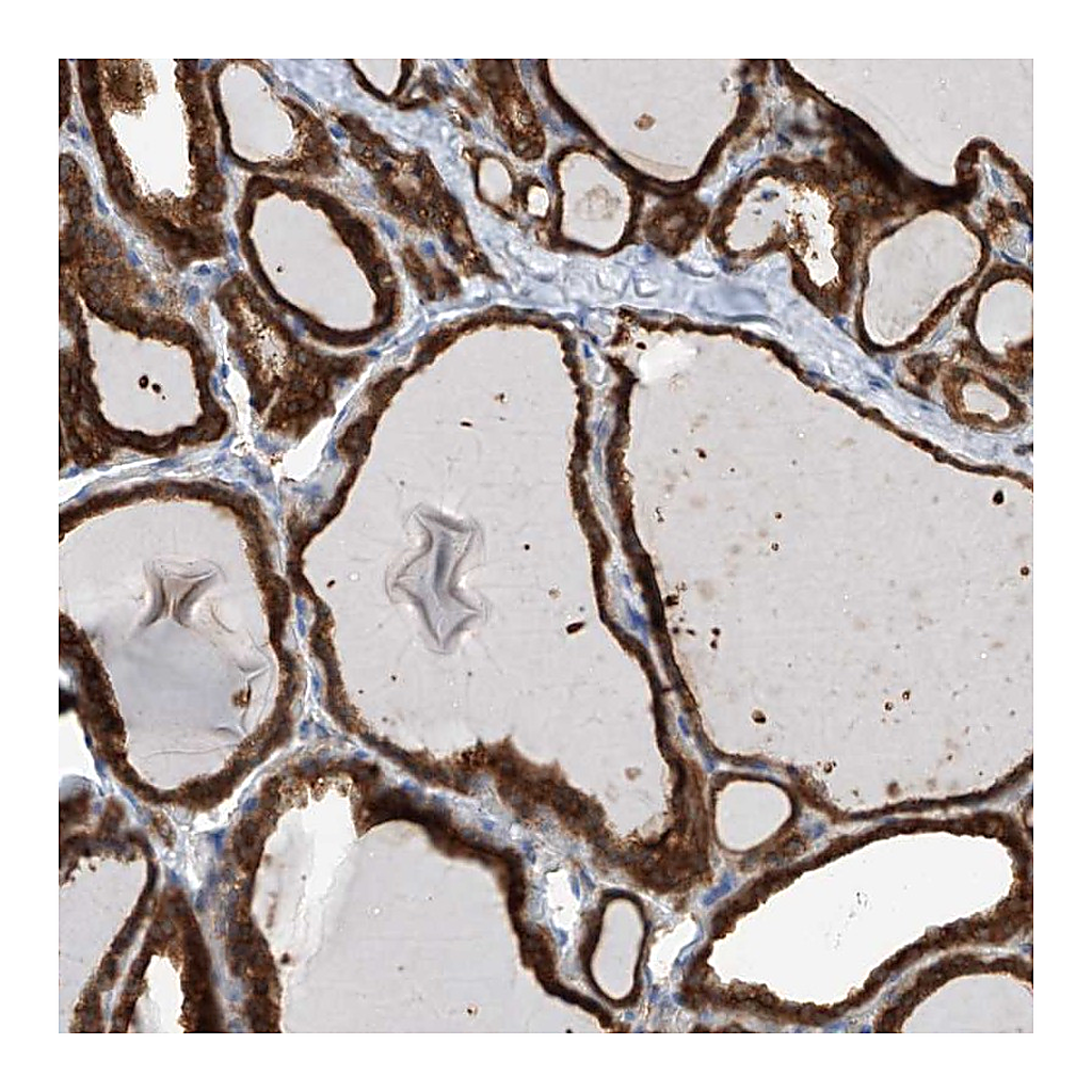 Atlas Antibodies Anti-OR4K1 Antibody