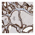 Atlas Antibodies Anti-OR4K1 Antibody