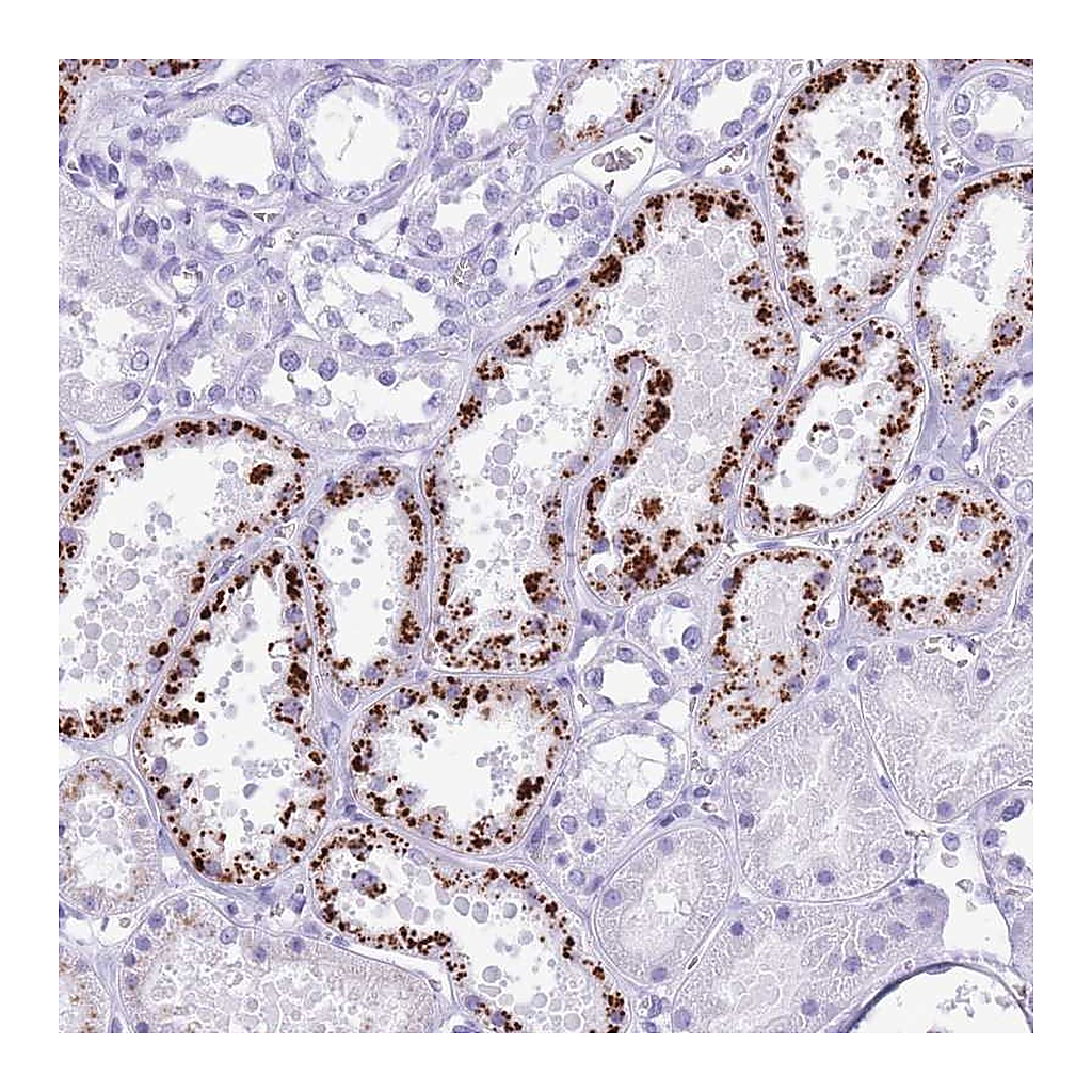 Atlas Antibodies Anti-OR4F3 Antibody
