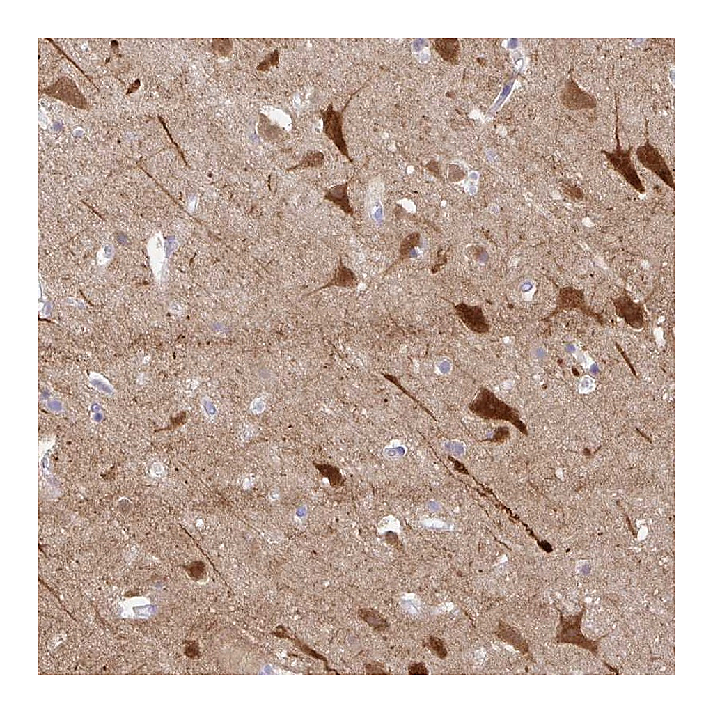 Atlas Antibodies Anti-OR4N4 Antibody