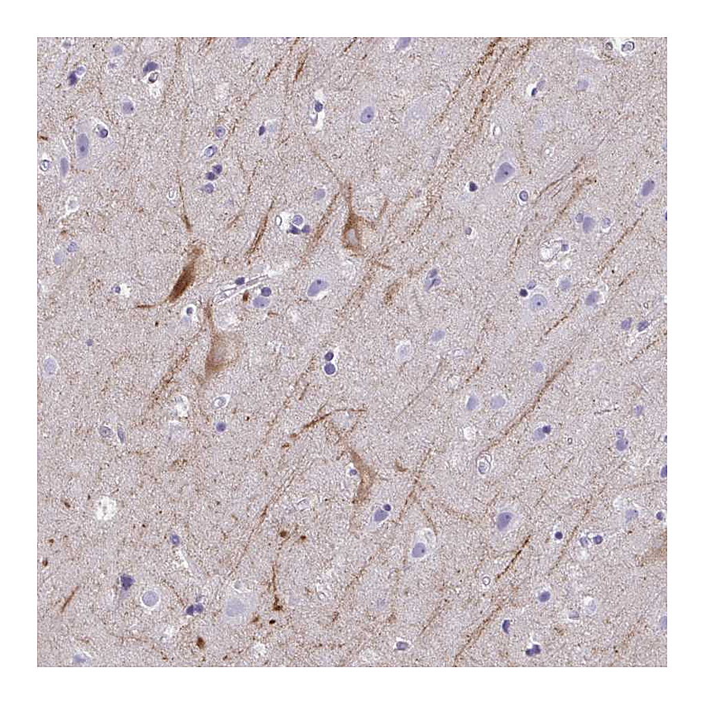 Atlas Antibodies Anti-OR4M2 Antibody