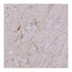 Atlas Antibodies Anti-OR4M2 Antibody
