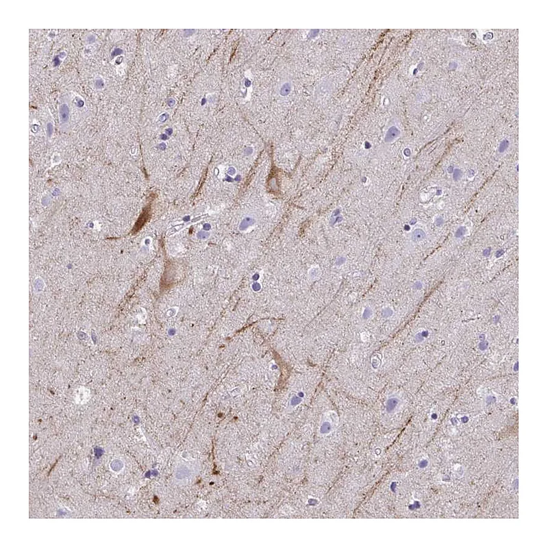 Atlas Antibodies Anti-OR4M2 Antibody