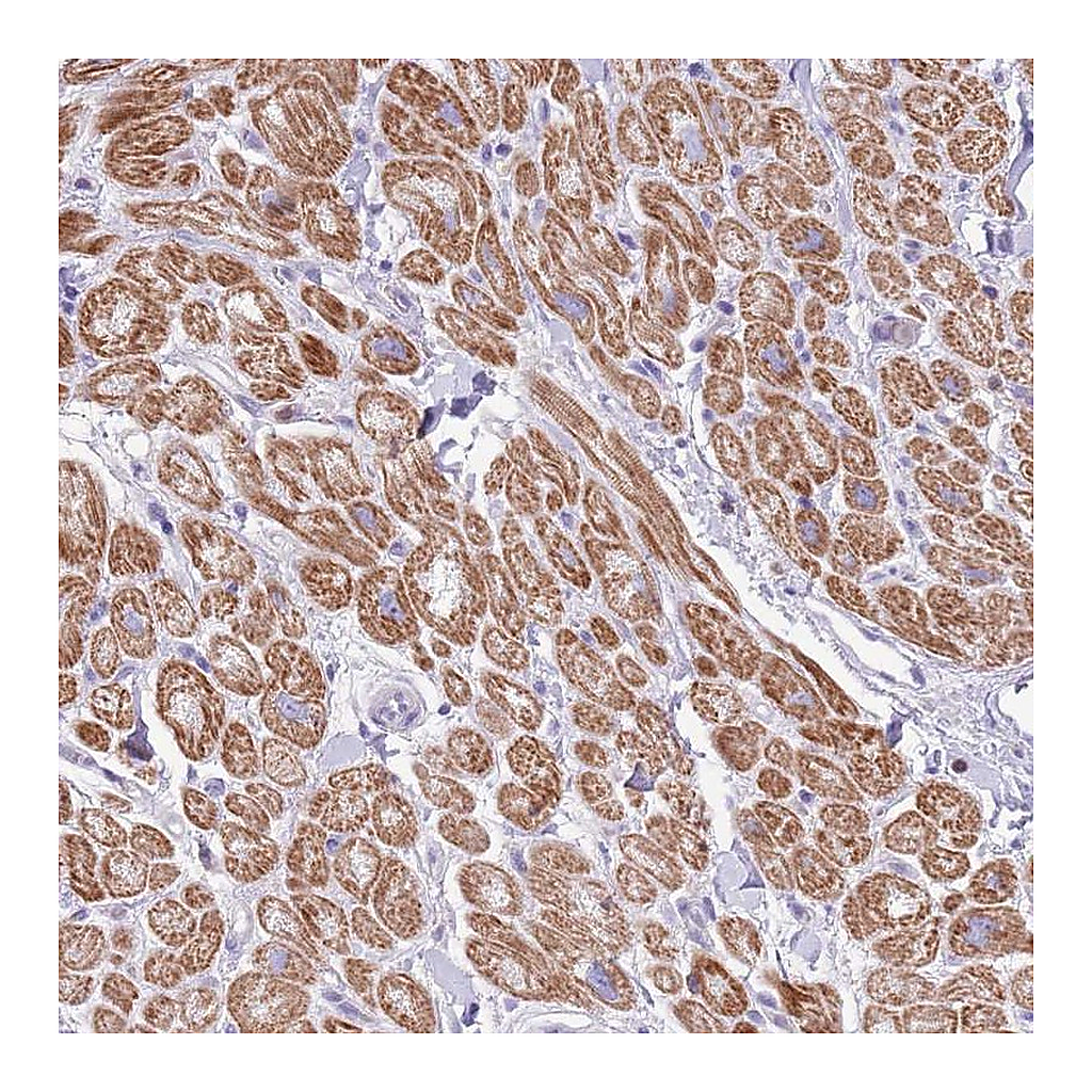 Atlas Antibodies Anti-OR4Q3 Antibody