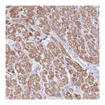 Atlas Antibodies Anti-OR4Q3 Antibody