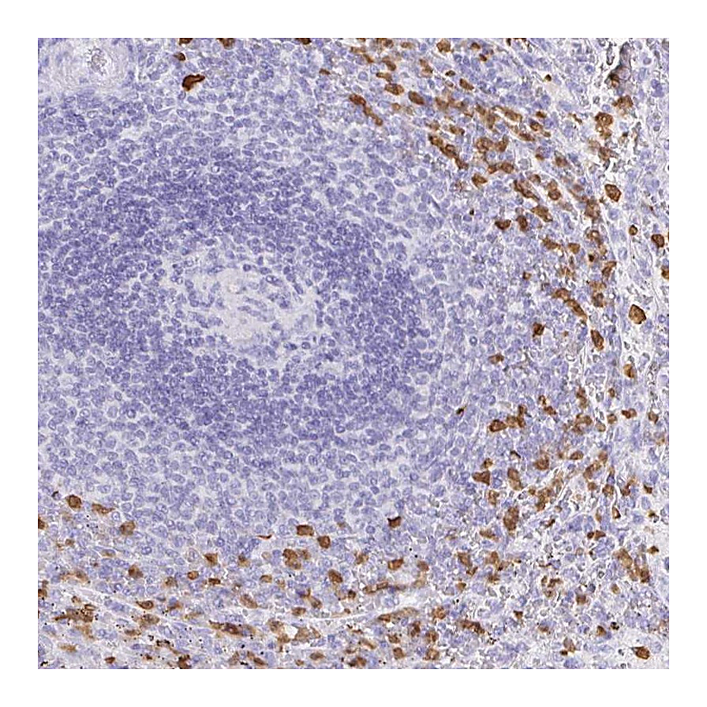 Atlas Antibodies Anti-OR51A7 Antibody