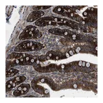 Atlas Antibodies Anti-OR51J1 Antibody