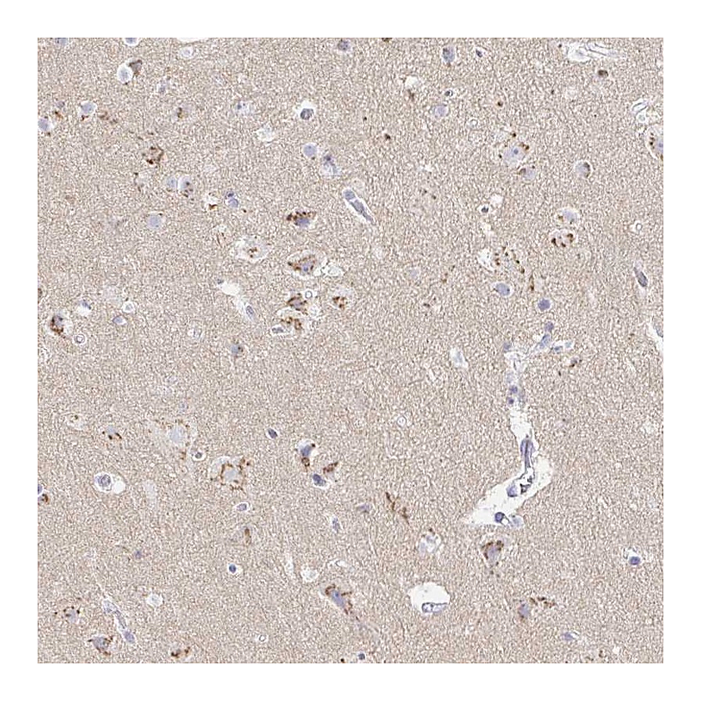 Atlas Antibodies Anti-OR51D1 Antibody