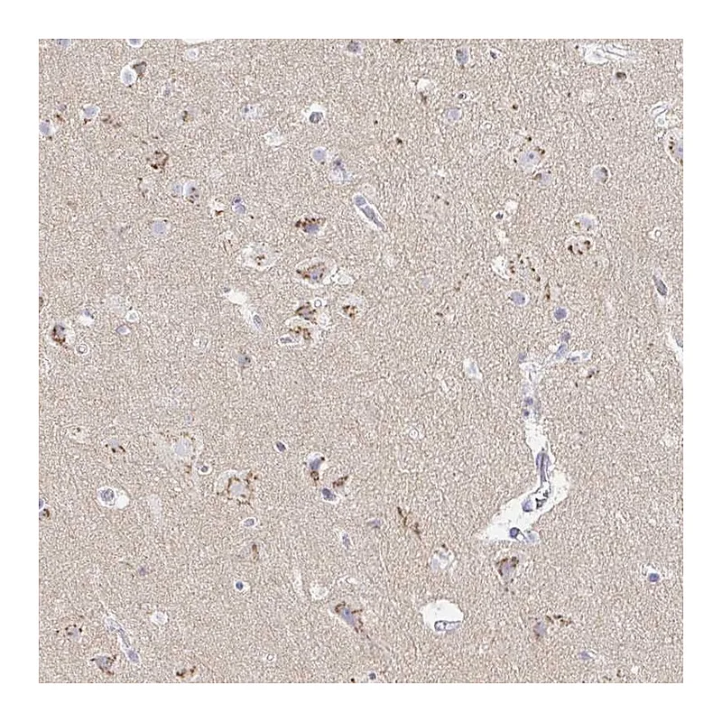 Atlas Antibodies Anti-OR51D1 Antibody