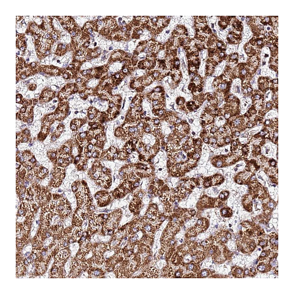 Atlas Antibodies Anti-OR51T1 Antibody