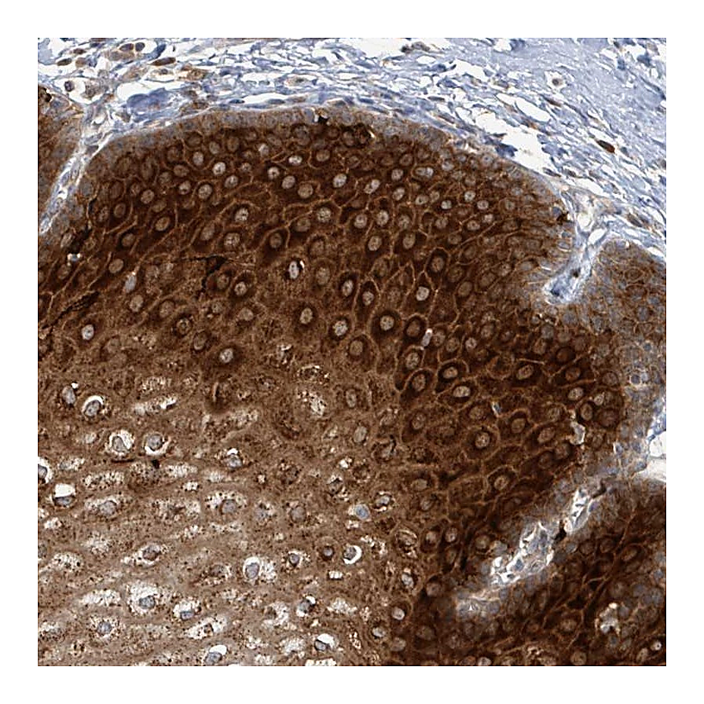 Atlas Antibodies Anti-OR51E1 Antibody