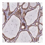Atlas Antibodies Anti-OR52I2 Antibody
