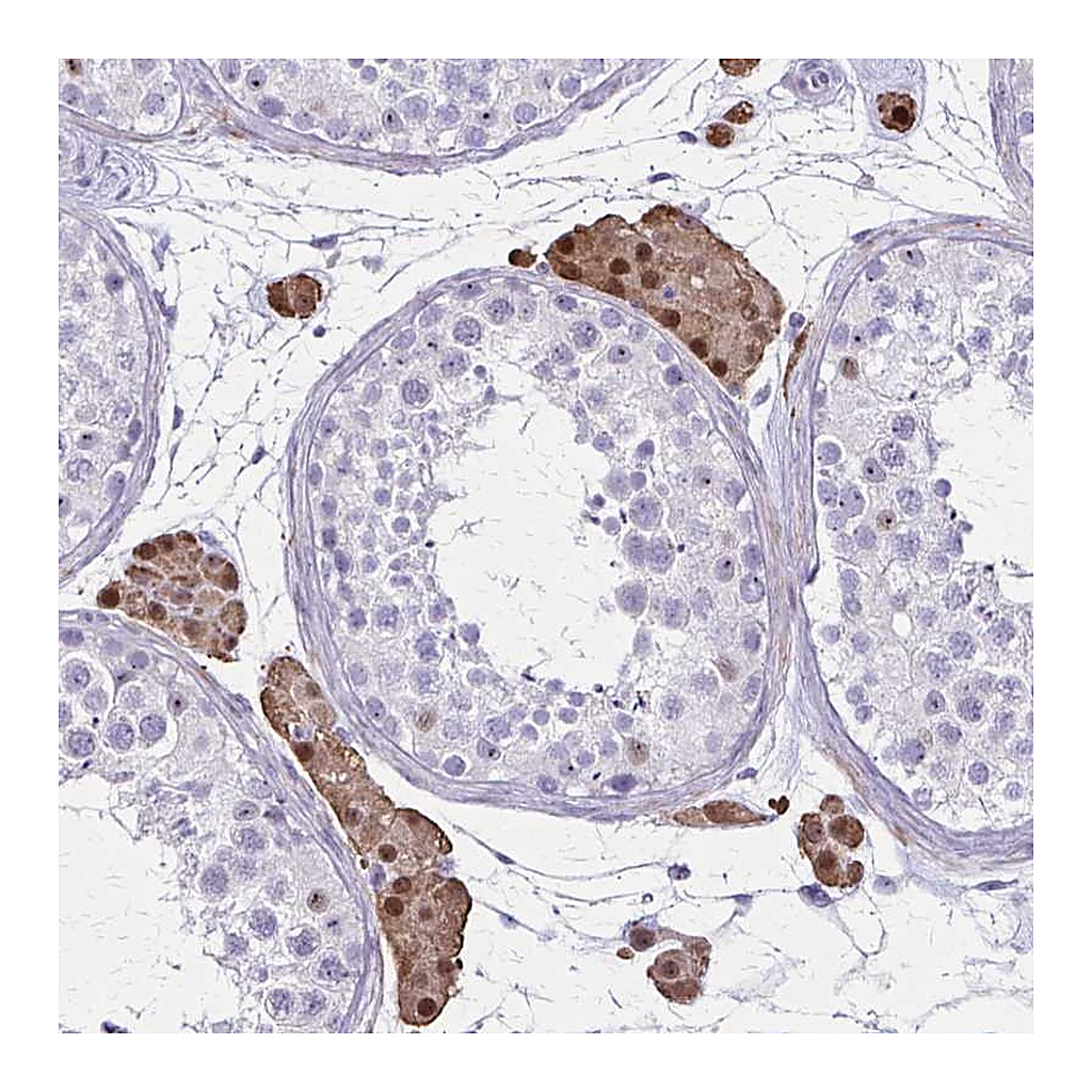 Atlas Antibodies Anti-OR51B5 Antibody